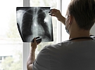 Rentgenové pracoviště v Hlinsku bude z důvodu rekonstrukce téměř měsíc uzavřené