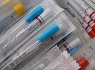 Odběrové místo k testování na COVID-19 je nově i v Chrudimi