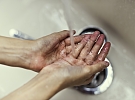 Na Chrudimsku se šíří žloutenka typu A, hygienici varují i obyvatele Hlinska a okolních obcí